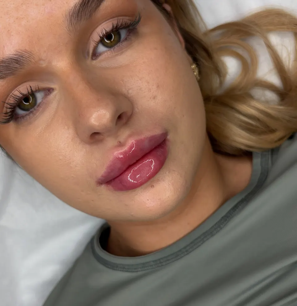 A subtle touch of volume on natural lips