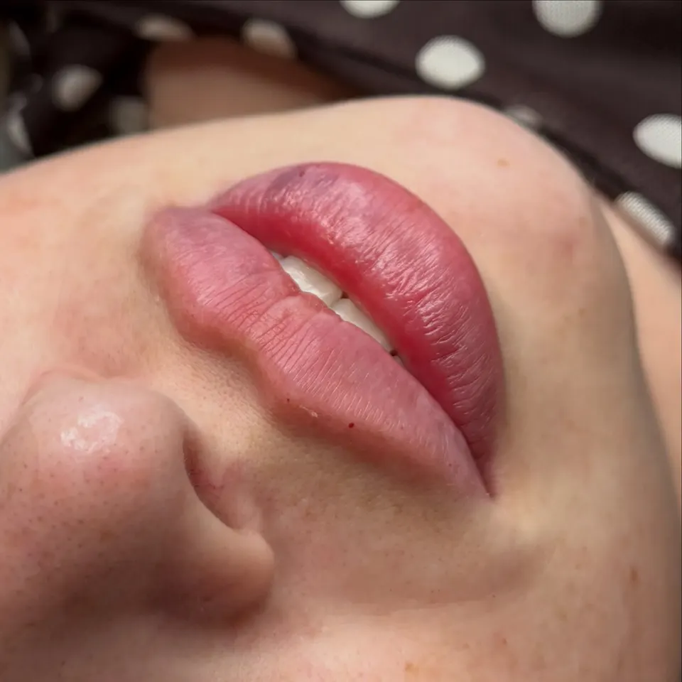 Soft, defined lips